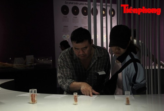 Triển lãm xác người: Người sợ sệt, kẻ hứng thú khi xem - ảnh 3