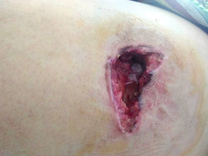 Người phụ nữ bị trâu húc vào đùi và hất lên cao - ảnh 1
