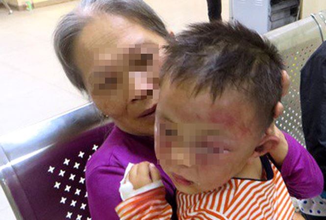 Bé 2 tuổi nghi bị bạo hành sẽ được hỗ trợ toàn bộ chi phí điều trị - ảnh 1