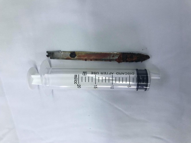 Phẫu thuật lấy lưỡi dao găm 11 năm trong cơ thể chiến sỹ công an - ảnh 3