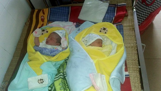 Bệnh viện biên giới mổ thành công sản phụ mang song thai còn nguyên ối - ảnh 1