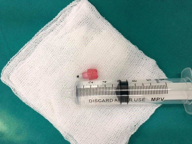 Cứu sống bé trai nuốt đầu bút chì khiến tim ngừng đập - ảnh 1