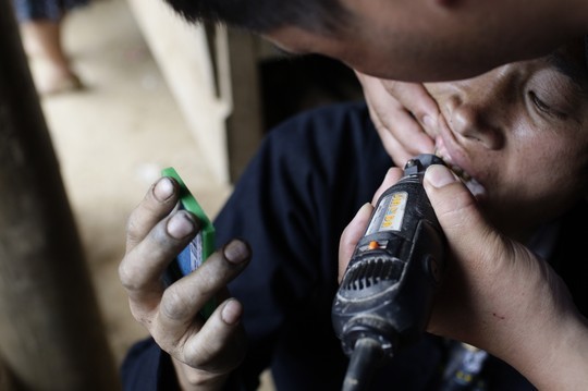 Đầu năm, xem làm 'răng vàng may mắn' - ảnh 2