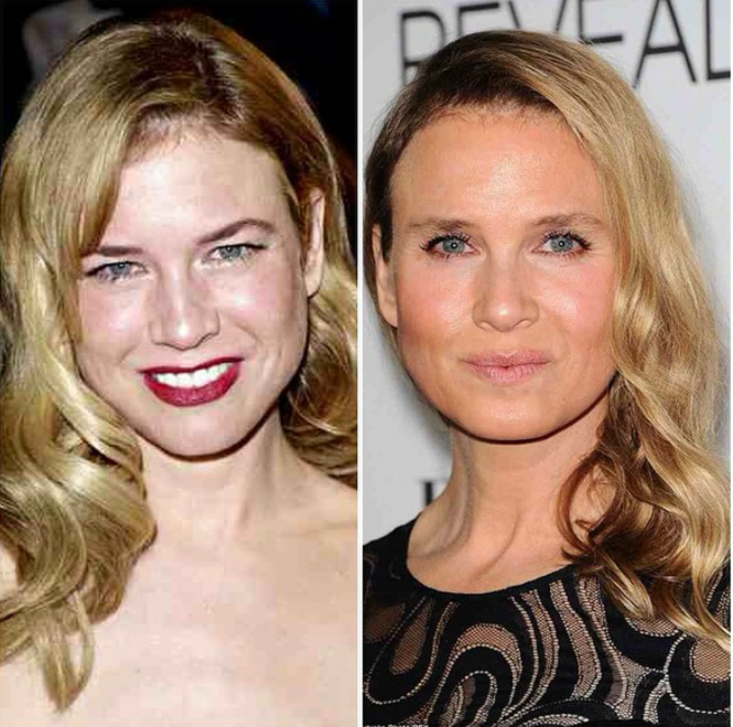 Renee Zellweger, Nhật ký tiểu thư Jones, phẫu thuật thẩm mỹ, tin đồn dao kéo - ảnh 1