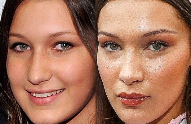 ‘Chân dài’ gợi cảm Bella Hadid khẳng định chưa từng ‘dao kéo’ thẩm mỹ - ảnh 2