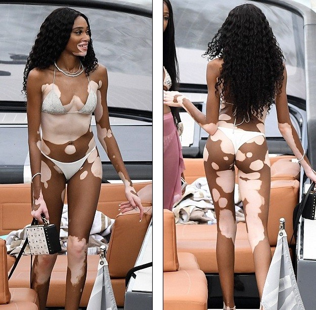 Siêu mẫu Winnie Harlow diện bikini nhảy múa trên du thuyền triệu đô - ảnh 1