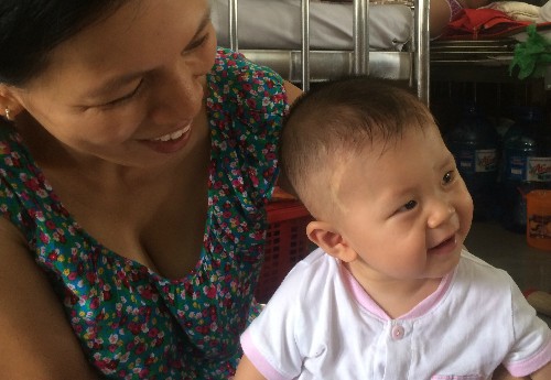 Bé bị đâm xuyên não tròn 9 tháng tuổi - ảnh 1
