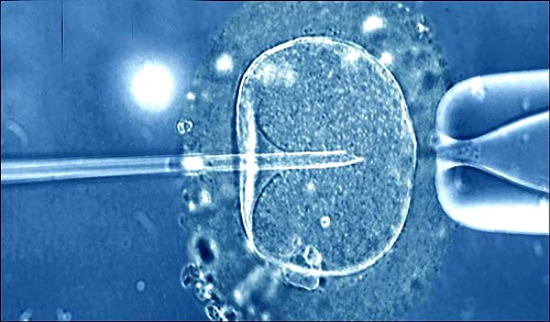 Tò mò ‘xem’ chuyển phôi dự trữ vào tử cung - ảnh 1