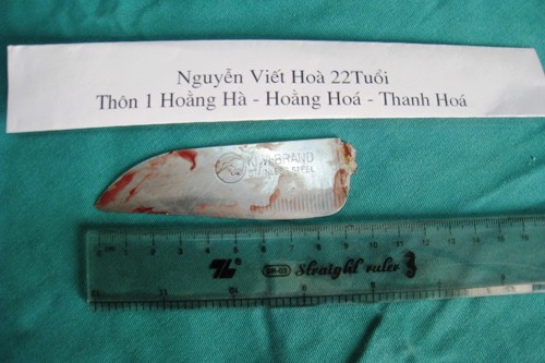 Cứu sống thanh niên bị đâm thủng phổi, đứt tủy sống - ảnh 1