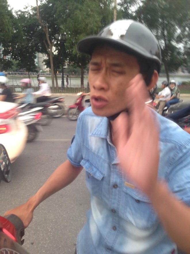Vờ bị chẹt chân, chặn xế hộp xin tiền trên phố - ảnh 1