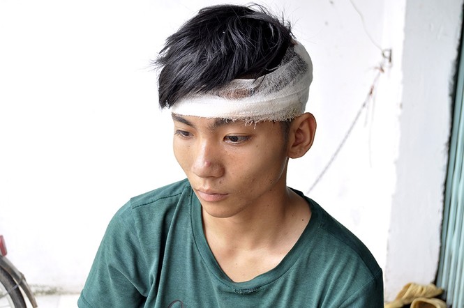 Truy bắt 10 kẻ côn đồ lao vào trụ sở UBND phường truy sát - ảnh 1