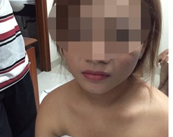 Nhiều chân dài được