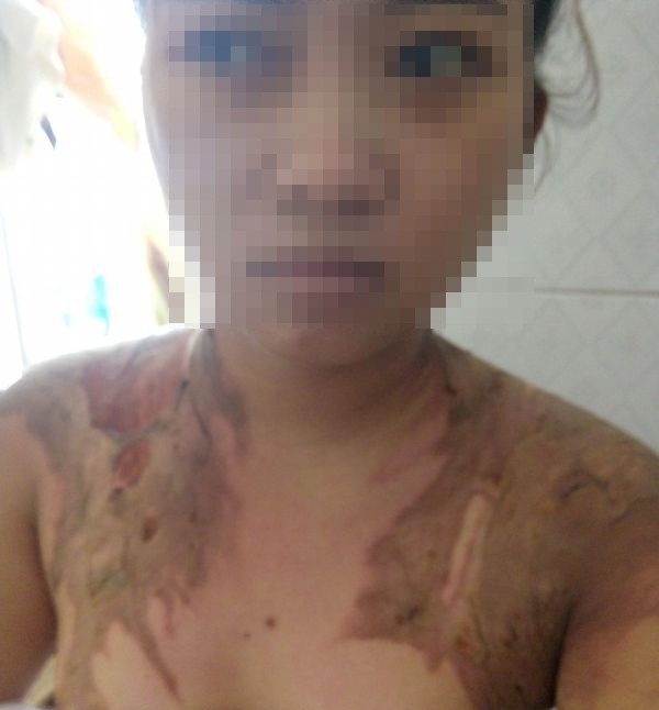 Bắt giam người đàn ông dội nước sôi lên cơ thể vợ - ảnh 1