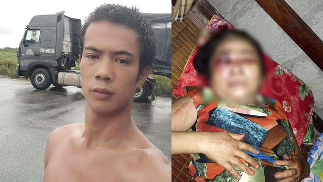 Mâu thuẫn trên chiếu bạc, người phụ nữ bị đánh hỏng mắt - ảnh 1