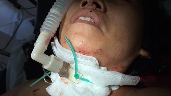 Bị cứa cổ, một phụ nữ nguy kịch - ảnh 1