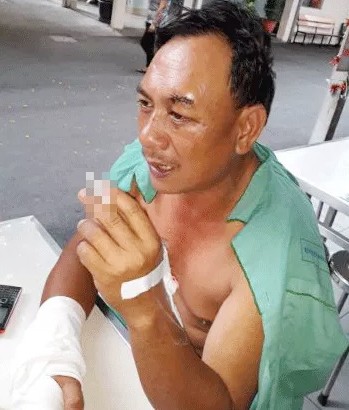 Đình chỉ công tác phó trưởng ấp bắn người - ảnh 1