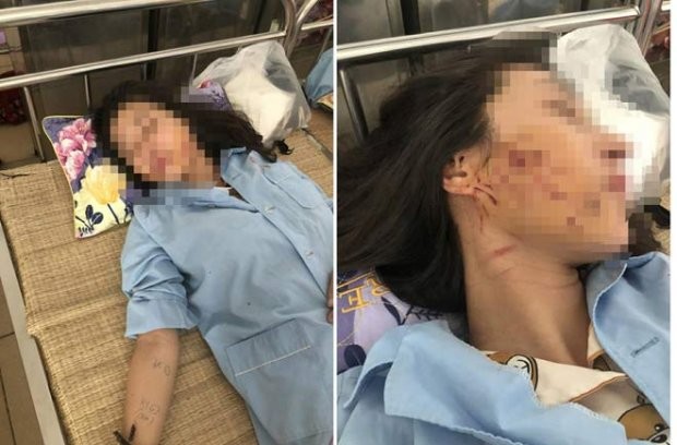 Cô gái bị 'lột đồ, đổ nước mắm' giữa phố lên tiếng - ảnh 1