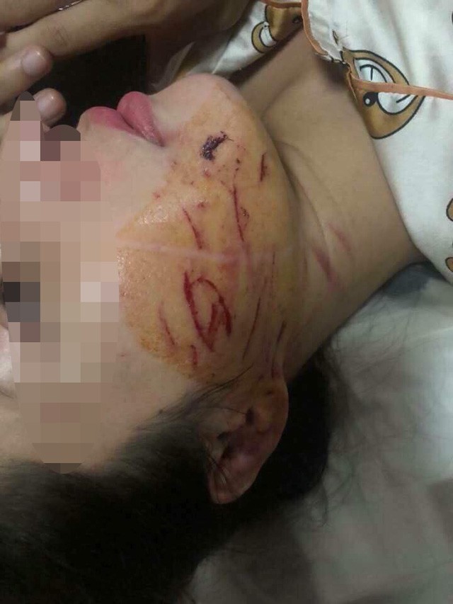 Vụ cô gái bị lột đồ, đổ nước mắm lên người: Triệu tập 2 đối tượng - ảnh 1