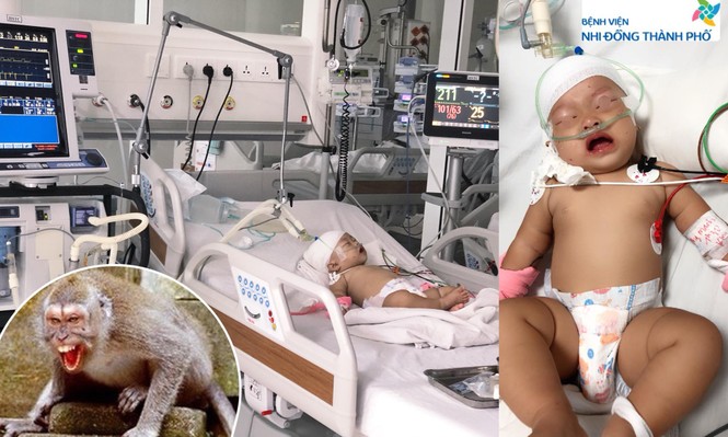 Bé gái bị lột hết da đầu vì khỉ hàng xóm tấn công - ảnh 1