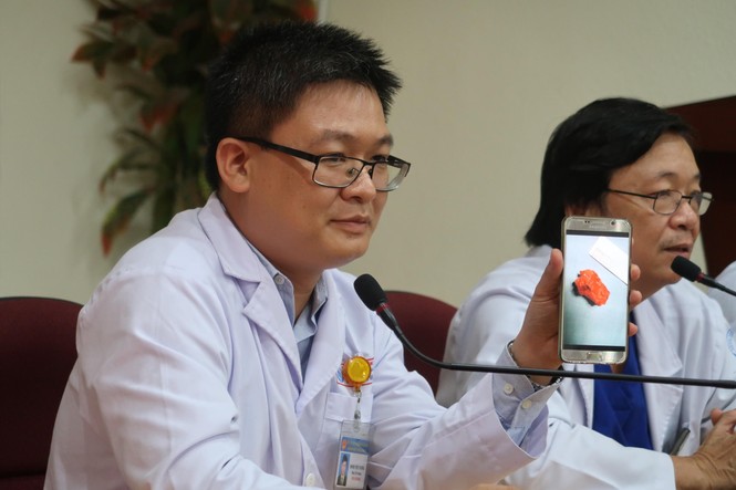 Ho kéo dài không khỏi, bé gái suýt chết vì khối bướu hiếm gặp - ảnh 1