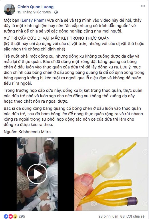 Clip nữ bác sĩ lấy đồng xu trong miệng em bé gây sốt cộng đồng mạng - ảnh 1