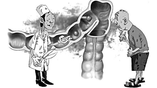 Viêm đại tràng - Điều trị ngay khi có dấu hiệu - ảnh 1