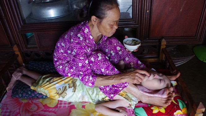 Mẹ già yếu nuôi con tật nguyền - ảnh 1