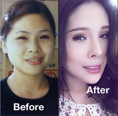 12 lần dao kéo để trở nên đẹp hoàn mỹ - ảnh 1