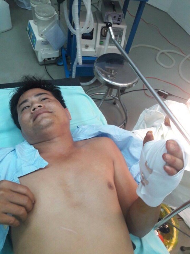 Vật thể giống súng bút phát nổ, nam thanh niên nhập viện cấp cứu - ảnh 1