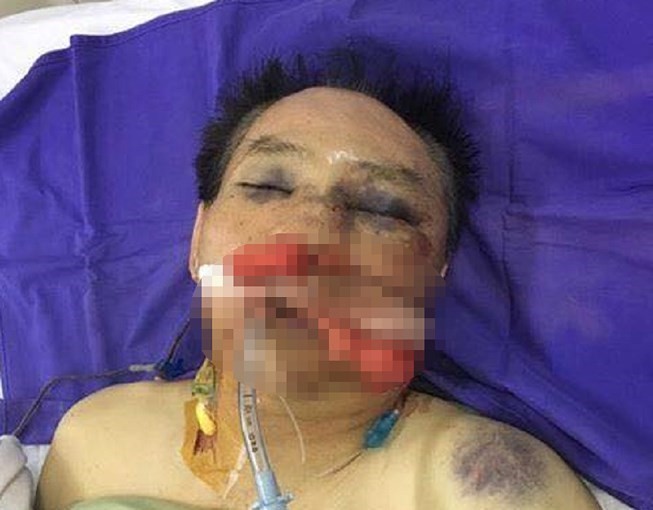 Khởi tố nguyên đại tá công an - ảnh 1