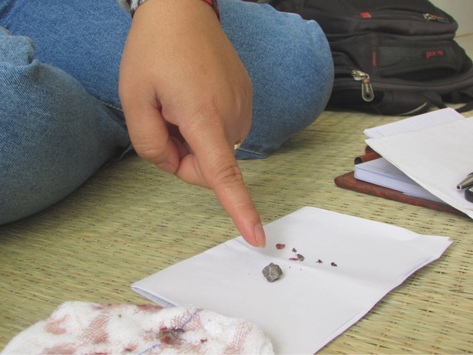 Đắk Lắk: Đi dự tiệc, một người bị bắn nhiều phát đạn trọng thương - ảnh 1