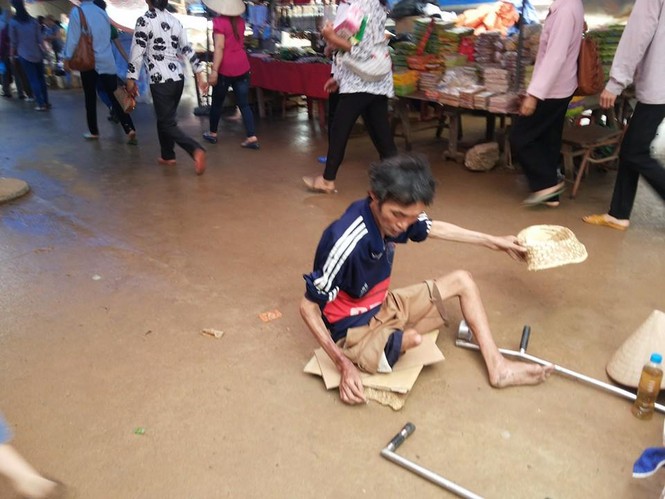 Quán cóc, cái bang... “bủa vây” chùa Bái Đính - ảnh 3