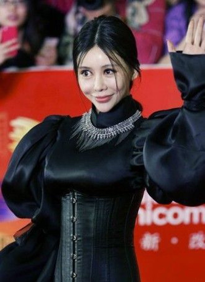 Hàng vạn người tàn phế vì giải phẫu thẩm mỹ - ảnh 1