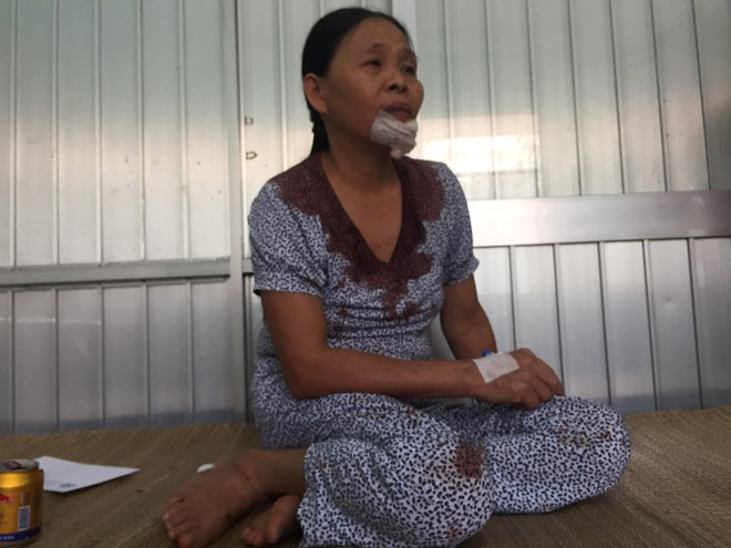 Chuyện về những người thoát chết vụ tai nạn ở Bình Thuận - ảnh 1