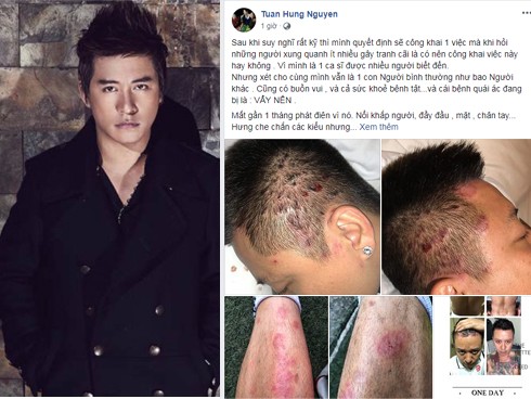 Showbiz 22/6: Tuấn Hưng suy sụp vì bị bệnh 'khó lòng chữa khỏi' - ảnh 5