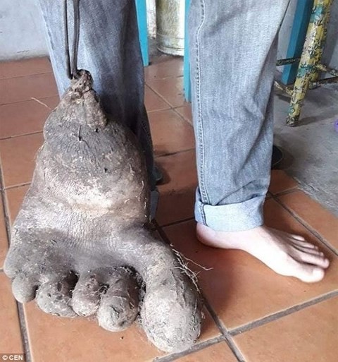 Lạ lùng củ khoai tây 8kg, y hệt bàn chân người khổng lồ - ảnh 1