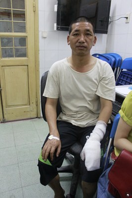 Anh Ngụy Đình Mạnh - một người dân tham gia chữa cháy lúc ngọn lửa mới bùng phát cũng bị bỏng ở phần bàn tay
