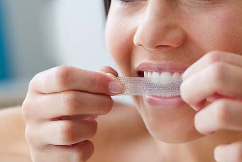 Miếng dán trắng răng siêu tốc cũng gây xôn xao thị trường làm đẹp năm 2013