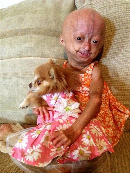 Đối với Rose, mỗi ngày trôi qua là một món quà đặc biệt