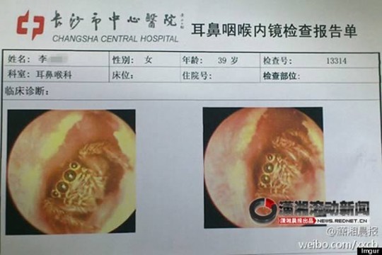 Những con vật khủng khiếp từng chui lỗ tai người - ảnh 2