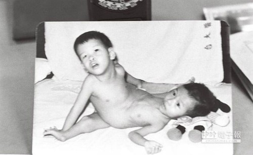 Đám cưới như mơ của người từng dính liền với anh ruột - ảnh 1