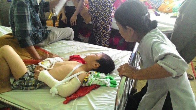 Khởi tố cha dượng đánh gãy tay chân, nứt sọ con riêng của vợ - ảnh 1