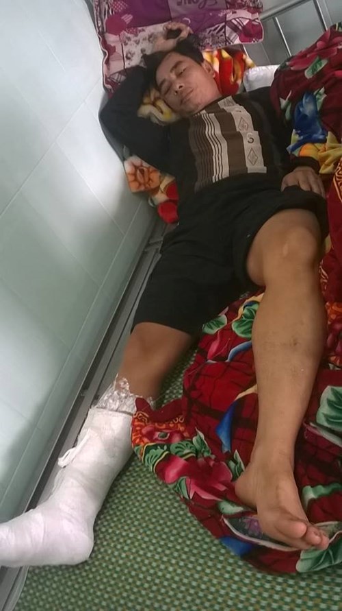 Phó giám đốc bị côn đồ xông vào nhà, đánh gãy chân - ảnh 1
