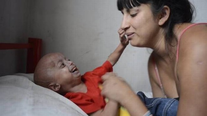 Cậu bé 4 tuổi 'mắc kẹt' trong ông cụ 80 tuổi - ảnh 4