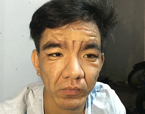 Những bệnh hiếm gặp lần đầu xuất hiện ở Việt Nam - ảnh 1