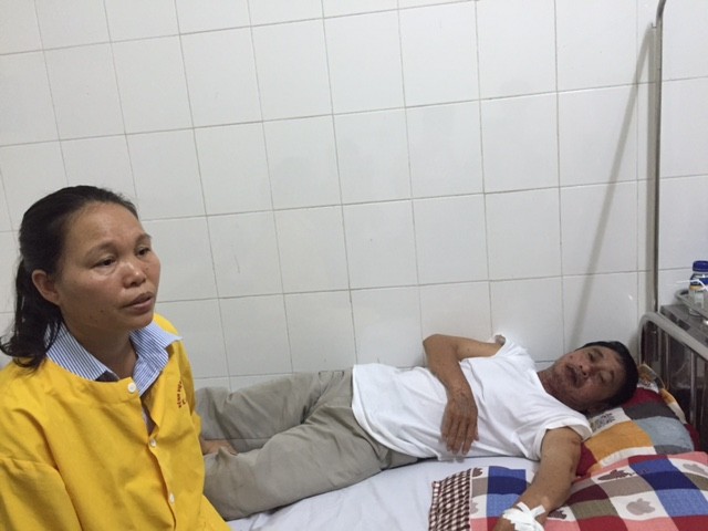 Người đàn ông nổi nốt, má rộp đỏ sau khi ăn cá nục - ảnh 1