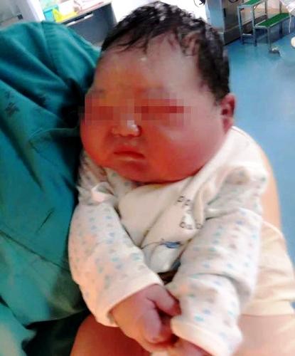 Người phụ nữ sinh con khổng lồ do ăn quá nhiều cháo - ảnh 1