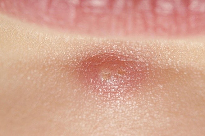 8 dấu hiệu không ngờ cảnh báo bạn bị stress - ảnh 6