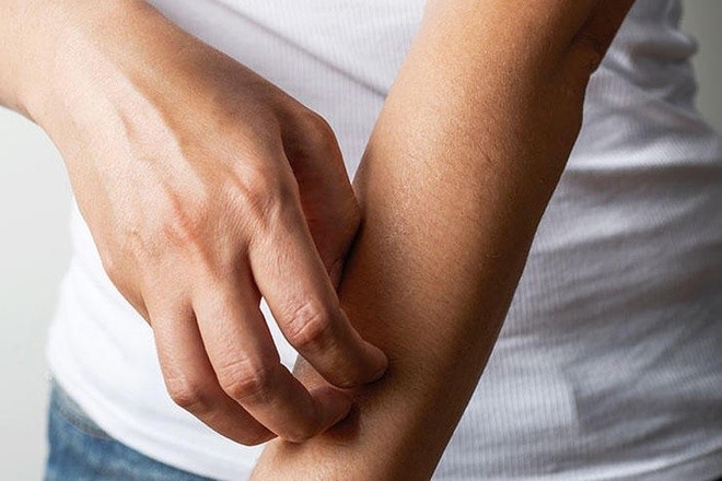 8 dấu hiệu không ngờ cảnh báo bạn bị stress - ảnh 7