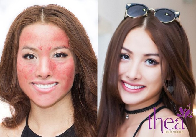 Thea Beauty Solutions ra mắt gói chăm sóc da siêu ưu đãi - ảnh 2